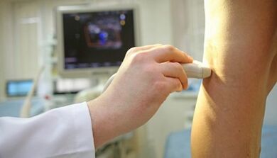 Laser treatment of varicose veins