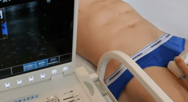 Diagnostic options for varicose veins of lower extremities